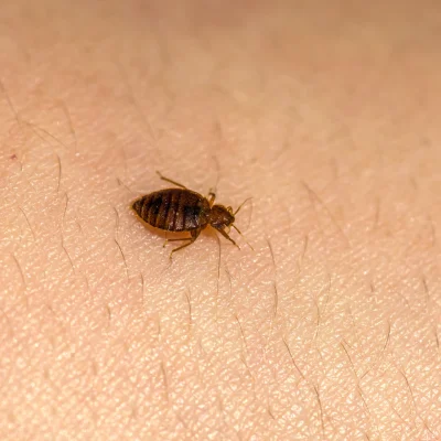 Bed bug crawling on a human skin. bed-bugs-treatment